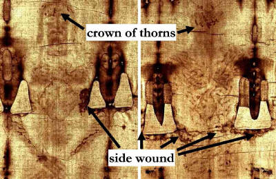 Holy Shroud Wounds